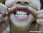 小斧牙呀,时尚生活达人，微密圈资源解析与争议探讨